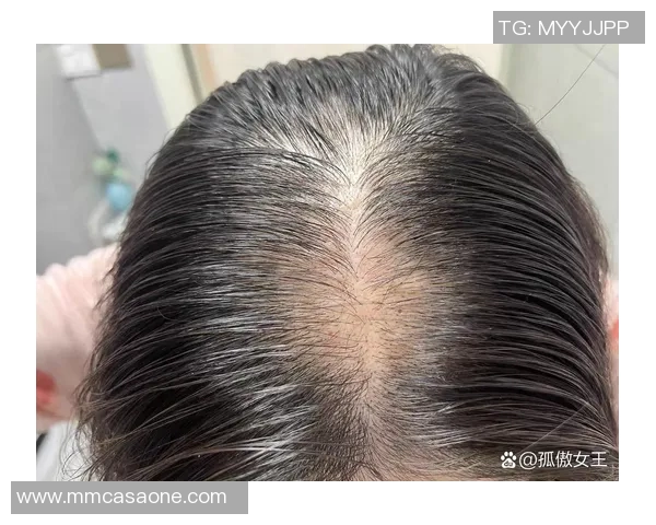 足球明星脱发排行榜揭晓谁是最受脱发困扰的球员 足球明星脱发排行榜揭晓谁是最受脱发困扰的球员